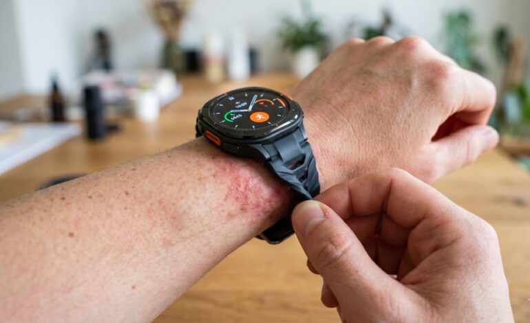 Wenn die Samsung Galaxy Watch nicht das Problem ist, sondern das Armband